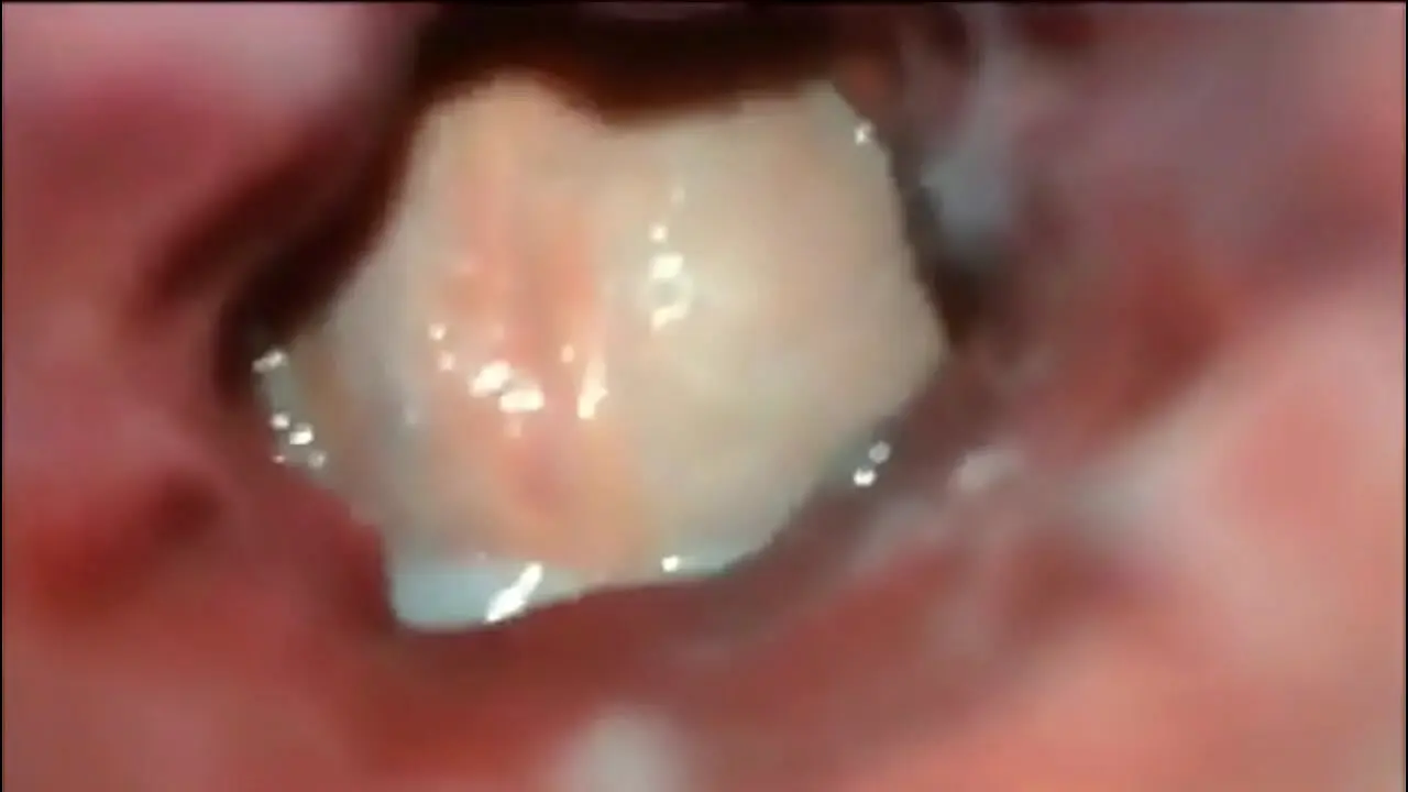 Anal Inside View